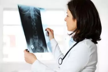 best hospital for stroke treatment in purnia, best doctor for stroke treatment in purnia, cost of stroke treatment in purnia