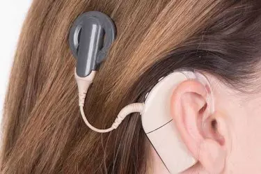 best hospital for cochlear implant surgery in Purnia, best doctor for cochlear implant surgery in Purnia, cost of cochlear implant surgery in Purnia